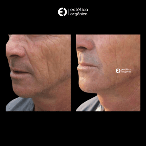 Post sem título 306