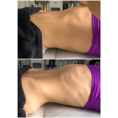 Treinamento Drenagem 3D